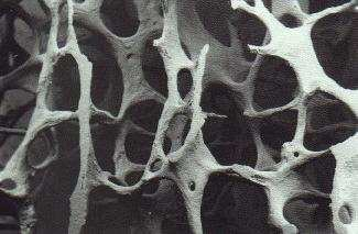 35 sobre a arquitetura do osso esponjoso são mais efetivos antes que ocorra a perfuração trabecular.