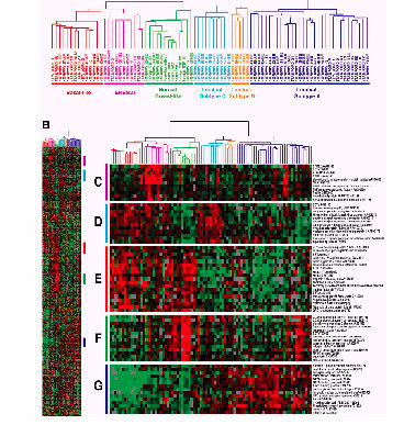 19 Figura 4 - Subtipos de câncer de mama definidos de acordo com arranjo de expressão de genes. Sorlie, T; et al. Proc Natl Acad Sci 2001; 98:10869.