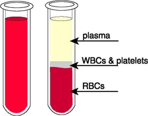 Composição do sangue O sangue pode ser separado em duas frações através de decantação Uma fração é o plasma que é composto água, aminoácidos,