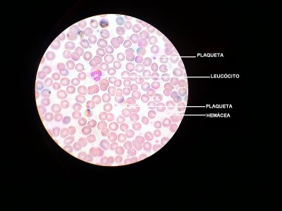 METODOLOGIA: 1) Utiliza-se o microscópio óptico, com todo cuidado, deixando-o pronto para uso.