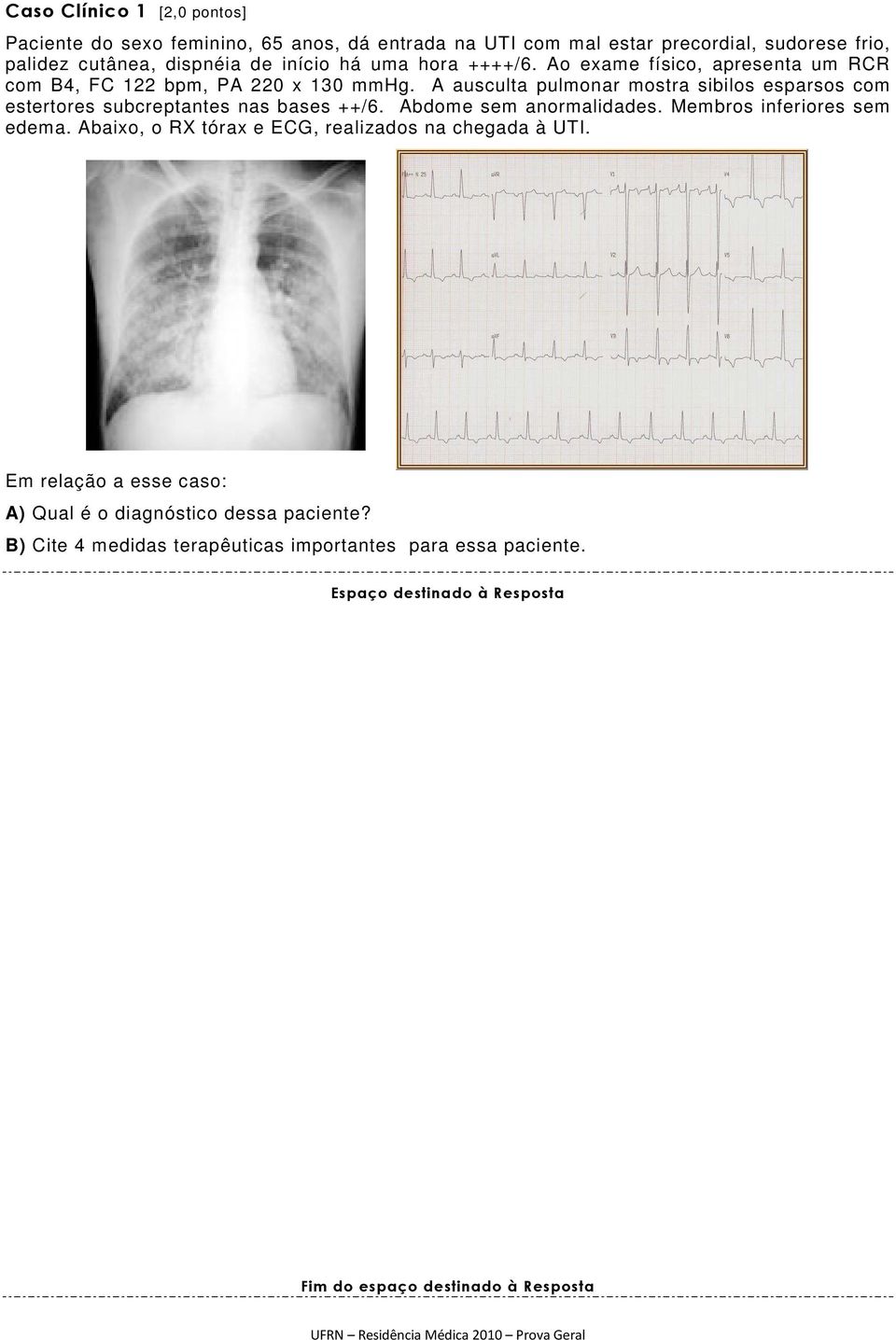 A ausculta pulmonar mostra sibilos esparsos com estertores subcreptantes nas bases ++/6. Abdome sem anormalidades. Membros inferiores sem edema.