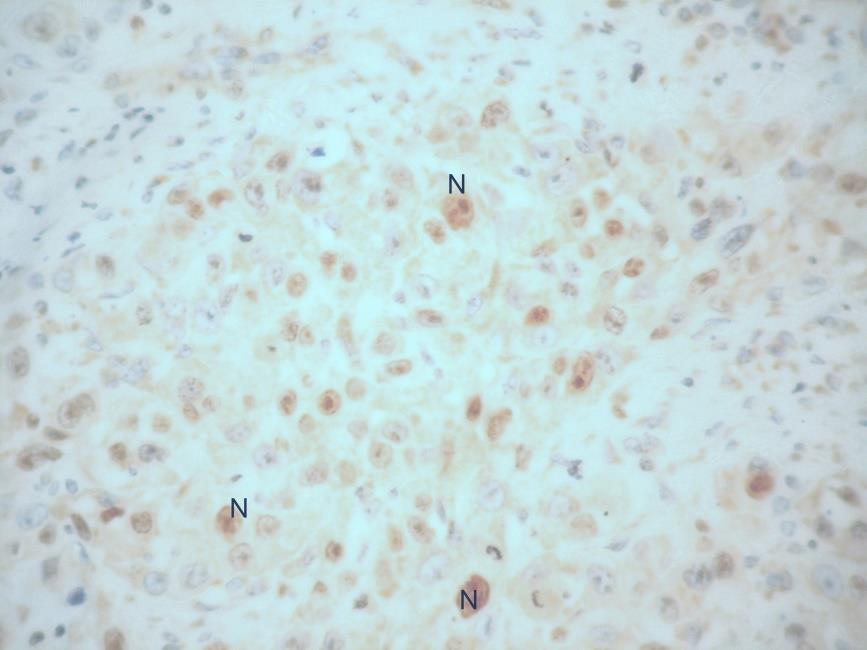 29 Figura 1. Imunohistoquímica da ciclina sem marcação.