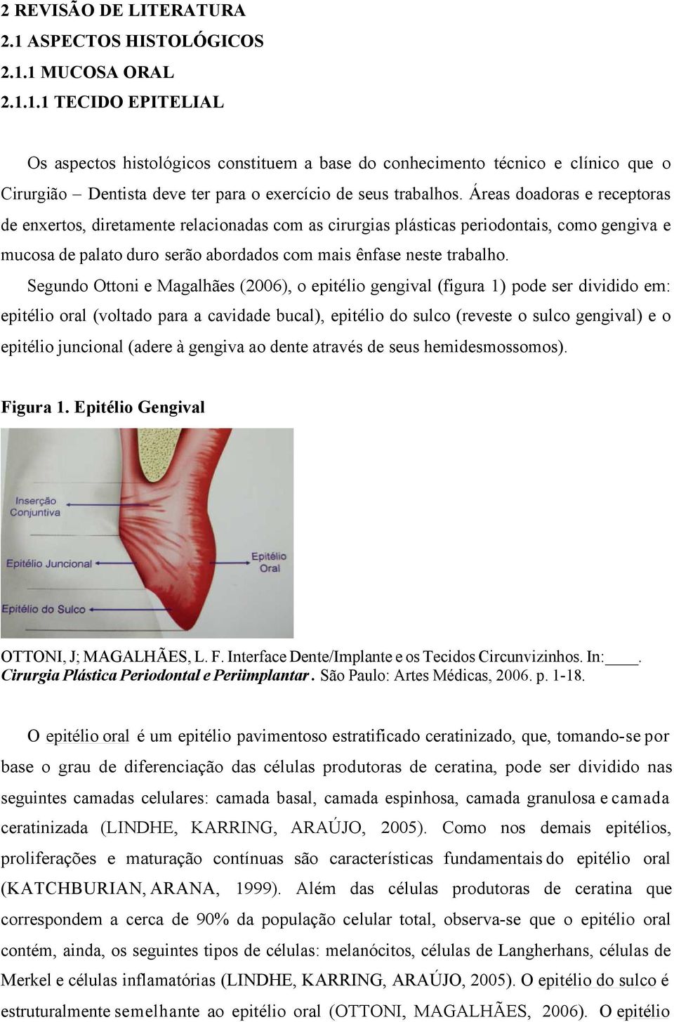 Segundo Ottoni e Magalhães (2006), o epitélio gengival (figura 1) pode ser dividido em: epitélio oral (voltado para a cavidade bucal), epitélio do sulco (reveste o sulco gengival) e o epitélio
