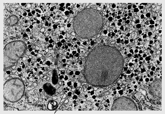 Homopolissacarídeos de reserva - Amido células vegetais e