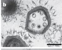 Os vírus gigantes Mimivírus, mamavírus Megavírus, pandoravírus Infectam amebas Genomas de 1,2 a 2,8 Mb Sputnik:
