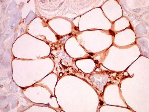 Lipídios - Triglicérides Seres humanos e outros mamíferos armazenam gordura em células adiposas que, além da reserva de energia, este tecido funciona como isolante térmico e como proteção contra