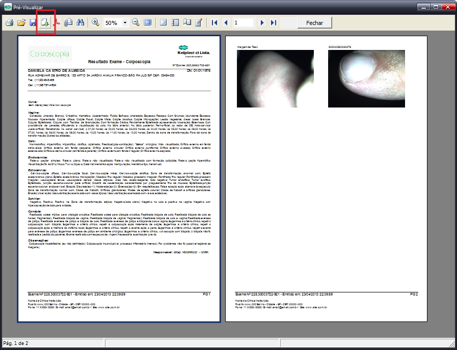 62 Colposcopia Tela 12 13- Exportar laudo
