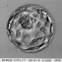 Ao final de várias mitoses, distinguem-se duas populações de células: Massa Celular Interna Trofoblasto Massa Celular Interna Embrião Propriamente Dito Porção Embrionária da Placenta Blastocele