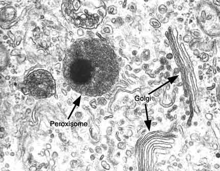 Células eucariontes Peroxissomos A principal função dos Peroxissomos é a oxidação de ácidos graxos, que serão utilizados para a síntese de