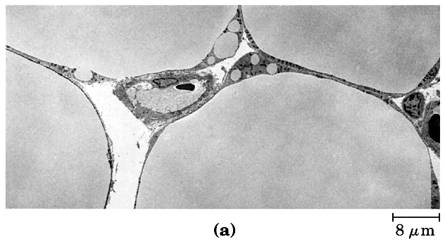 Nas células são acumulados em vesículas - células animais (adipócitos) e vegetais (principalmente em sementes) possuem no citoplasma gotículas de triglicerídeos Cotilédone Células vegetais eles são