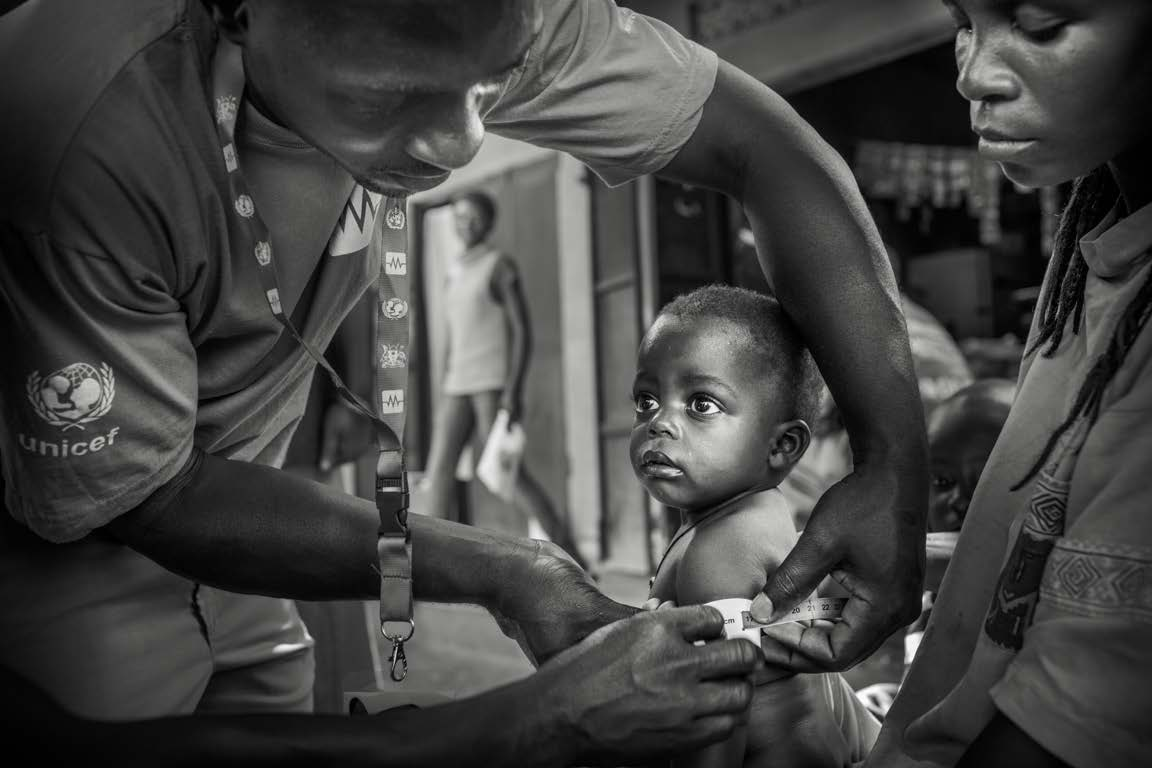 Projeto Vida Unicef trabalha com equipes de saúde locais para combater a desnutrição infantil nos