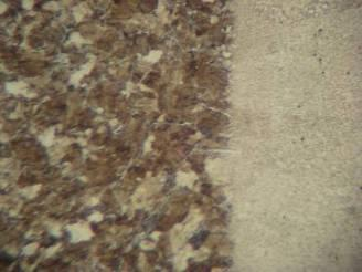 Observou-se a matriz perlitica/ferritica, grãos ferriticos tamanho 7 e 8, microestrtutura típica de aço médio carbono