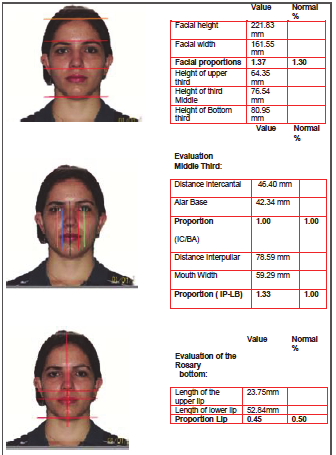 Comparação facial em sujeitos conhecidos 207 Figura