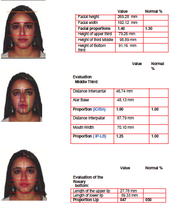 Comparação facial em sujeitos conhecidos 209 Figura