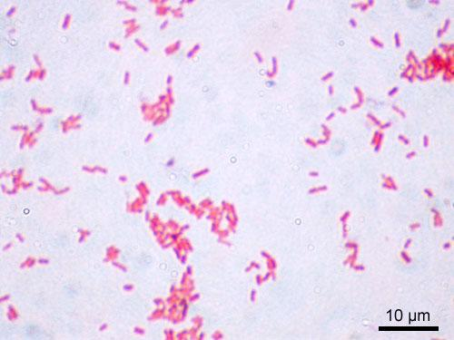 Caracterização do género Salmonella A Salmonella pertence ao grupo das Enterobactereaceas: Bastonetes Gram negativos, fermentadores
