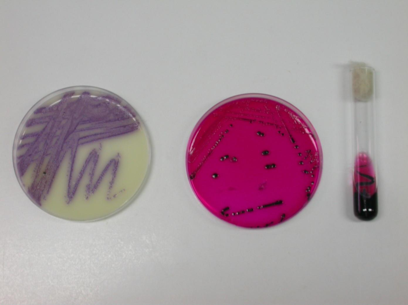 Caracterização do género Salmonella Isolamento Enriquecimento Enriquecimento Selectivo