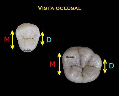 horizontal: terço vesabular, médio e lingual.