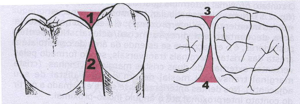 Formato das faces (vista proximal): dentes triangular e dentes posteriores trapezoidal.