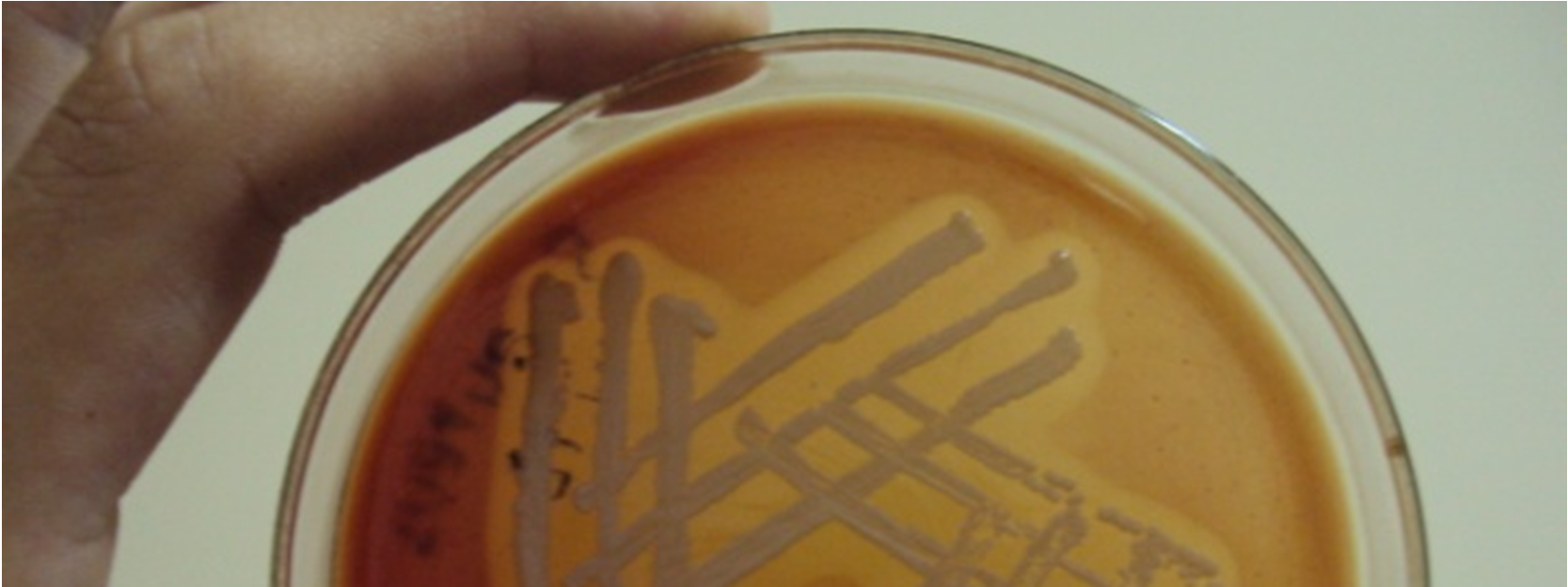 38 3.3.2 Análise microbiológica A análise foi realizada a partir das amostras de leite enviadas ao Laboratório de Bacteriologia e Saúde Populacional da UFPEL, sendo semeadas em placas de Petry com