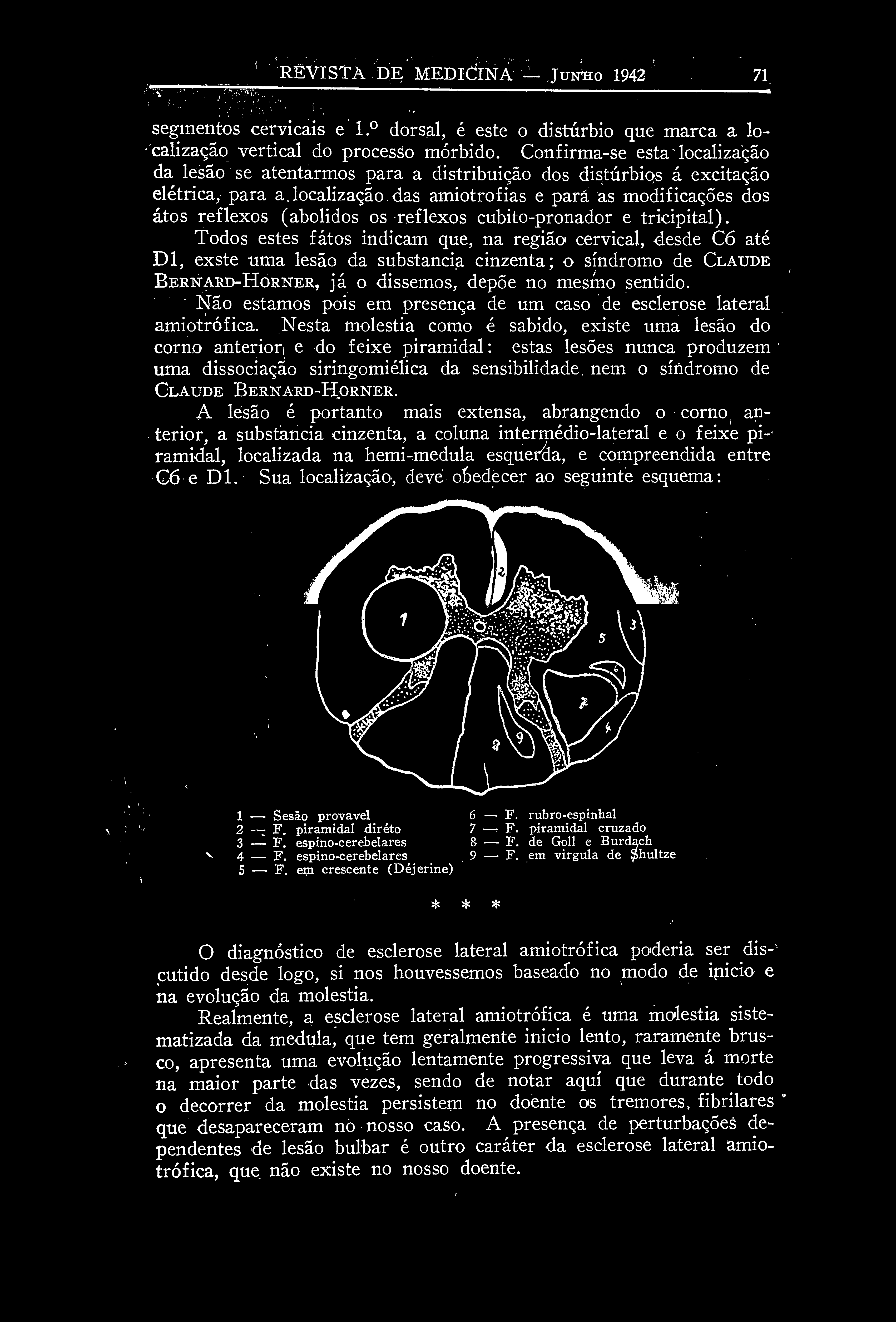 localização das amiotrofias e para as modificações dos atos reflexos (abolidos os reflexos cubito-pronador e tricipital).