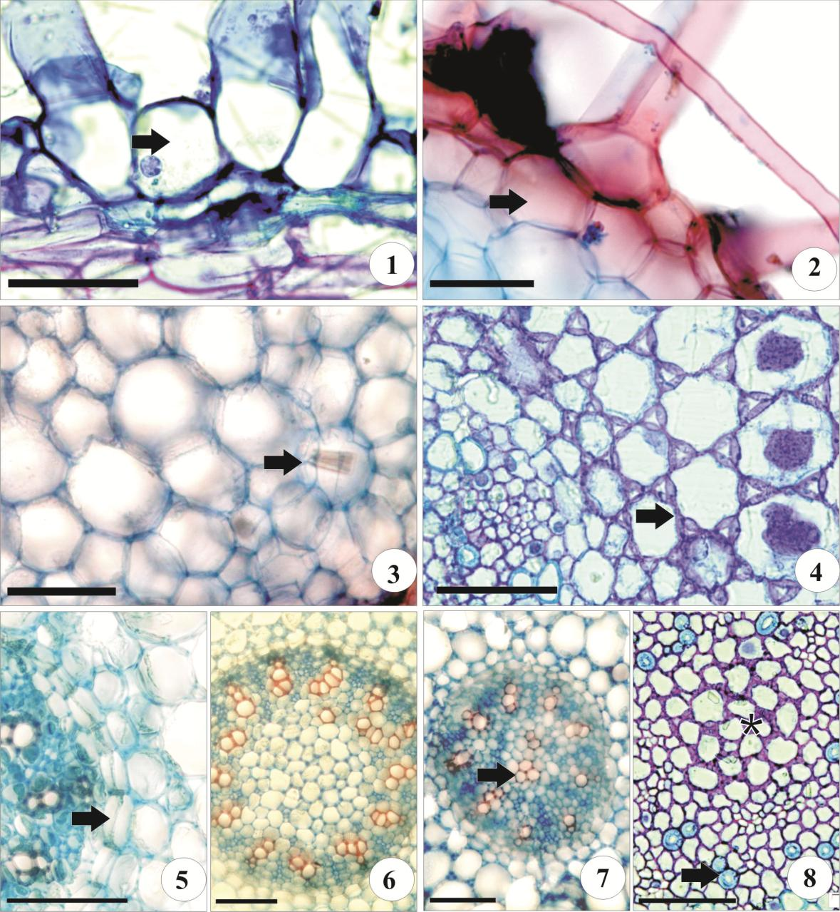 164 61: 1-8 Secções transversais da raiz de espécies de Goodyerinae (1). Aspidogyne rosea epiderme uniestratificada com células vivas (seta) (2). A. rosea, exoderne (seta) (3).