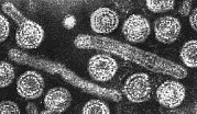 partículas recombinação Surgimento de novas amostras, com potencial epidêmico Influenza H5N1, H1N1 pandêmica Êrro na montagem: