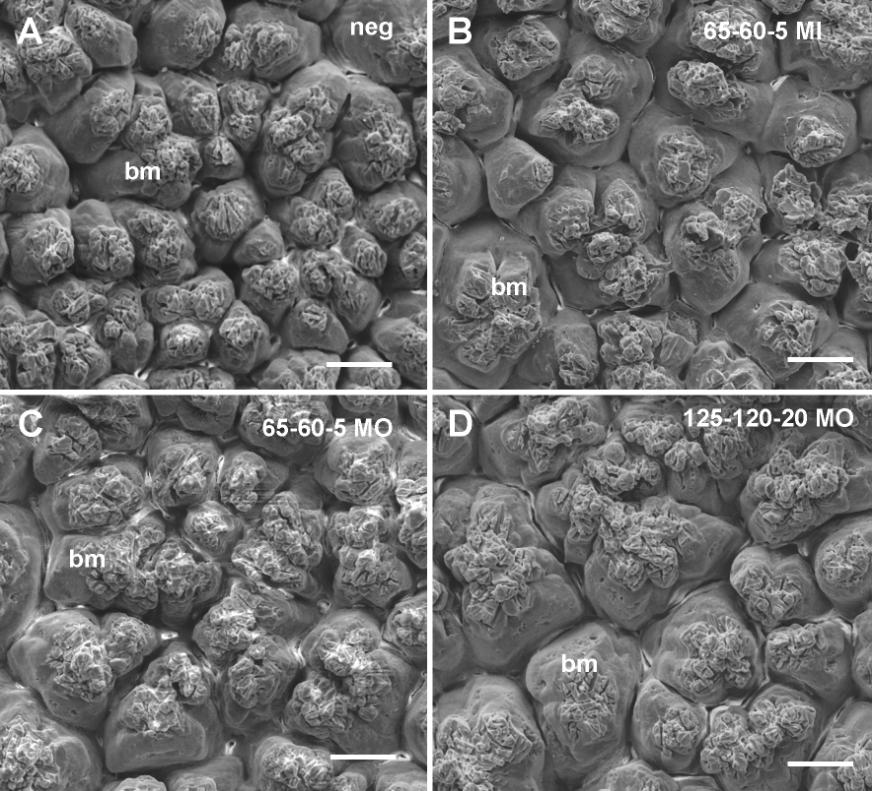Camada paliçada (µm) Botões mamilares/mm² 44 Figura 6 - Microscopia eletrônica de varredura da superfície interna da casca de ovos de poedeiras com 62 semanas de idade com maior aproximação em