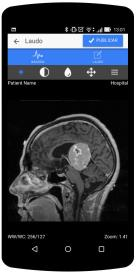 Pôsteres Uma Ferramenta de Diagnóstico Médico para Dispositivos Móveis Rafael de Faria Scheidtª, Filippi Rogerio da Silva b auniversidade Federal de Santa Catarina, Florianópolis, SC bfaculdade