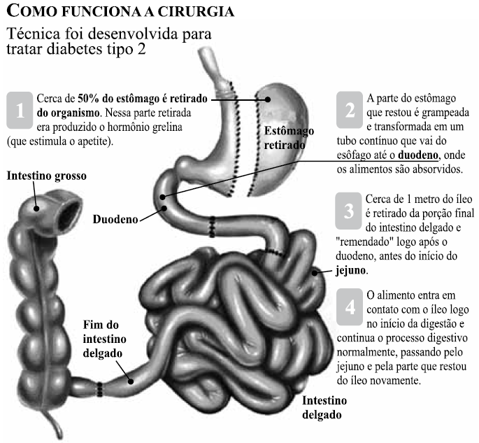 d) Oligoelementos são microminerais não essenciais para os seres vivos, apesar de serem encontrados em alta concentração nos organismos, podendo ser essenciais para a formação de enzimas vitais que