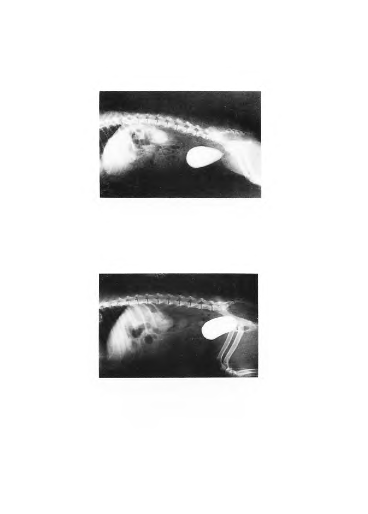 FIGURA 1 - Cistografia mostrando bexiga piriforme, superfície mucosa de contorno