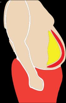 Pierre Maestri / Muito Além do Peso / 8 A gordura encontrada em nosso corpo é um lipídio indispensável, tendo um importante papel na função energética, estrutural e hormonal.