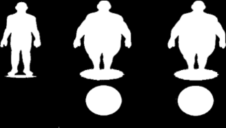 *imagem mostrando a distribuição de células de gordura em um indivíduo normal, obeso hipertrófico e obeso hiperplásico A quantidade elevada pode levar a doenças crônicas como cardiopatias, acidentes