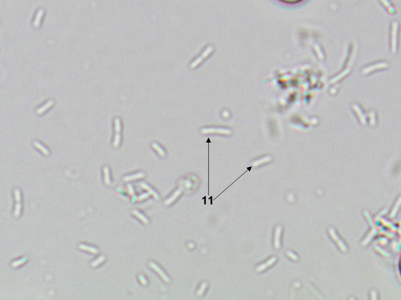 Sternheimer-malbin