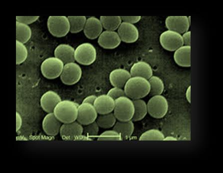 S. aureus Podem estar envolvidos Gama de processos infecciosos Agudas