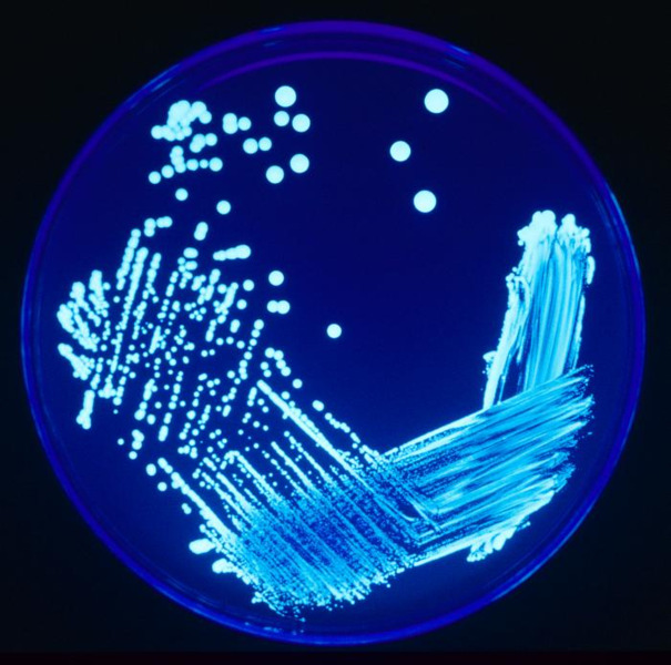 PROGRAMA DE CONTROLO E MONITORIZAÇÃO ANÁLISES ESPECÍFICAS À LEGIONELLA Realizadas em Laboratório rio Certificado; Contagem de ufc de