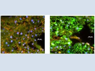 Como a Wolbachia atua no controle da dengue? fotos de microscopia mostram tecidos do Aedes aegypti em situações de presença e ausência da Wolbachia.