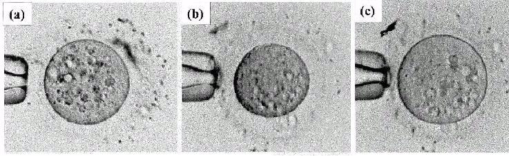 22 Figura 8 Alteração osmótica em ovócito em função da exposição ao crioprotetor, sendo: (a) morfologia normal de um ovócito humano maduro exposto a um meio isotônico; (b) ovócito retraído após 30s