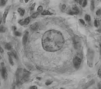 (B) Folículo em crescimento morfologicamente normal criopreservado com EG (C) Folículo primordial degenerado criopreservado