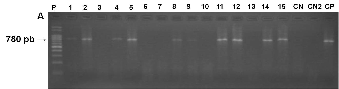 63 Figura 7: Gel de agarose dos produtos da 2ª reação de PCR obtidos pelo método kdna snpcr referente às amostras de pele. P: padrão de peso molecular 100pb.