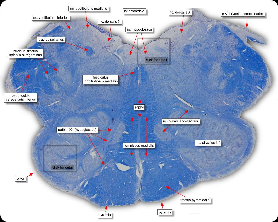 IV Ventrículo Núcleo do hipoglosso Núcleo