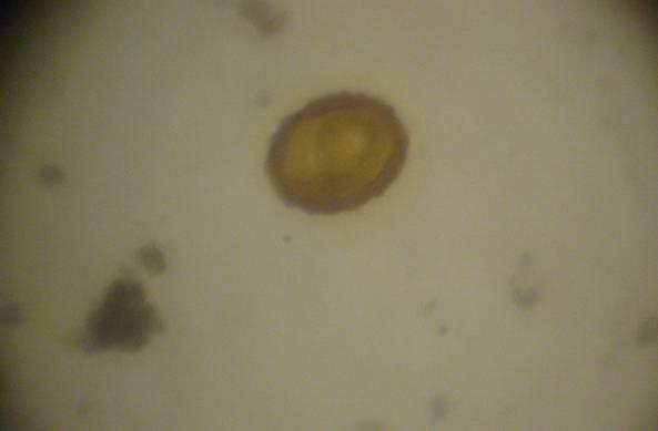 Figura 3: Ovo de helminto viável encontrado na varredura.