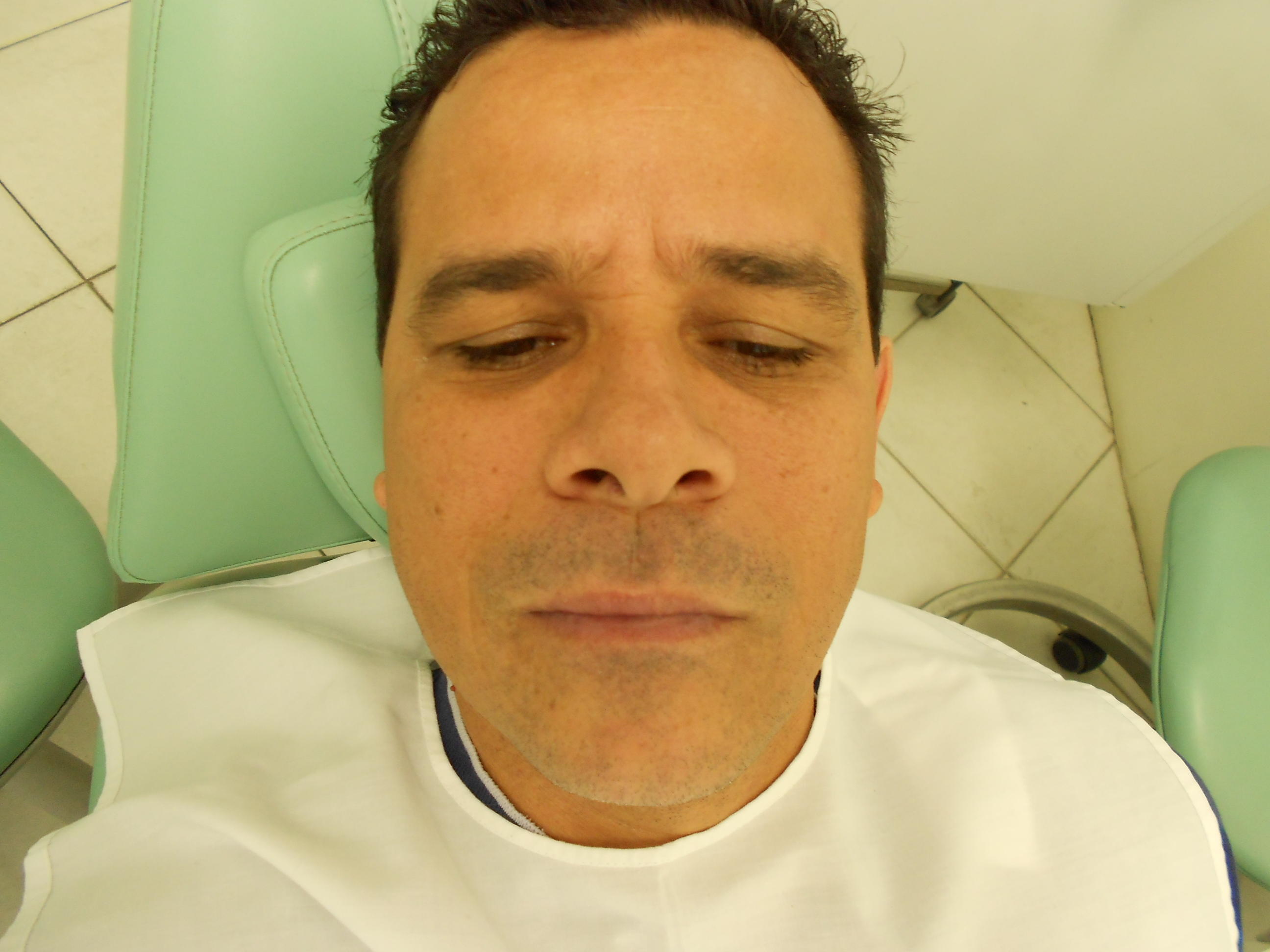 20 4 CASO CLÍNICO Paciente J.E.M em julho de 2012 procurou atendimento odontológico, em consultório particular, para tratamento ortodôntico.