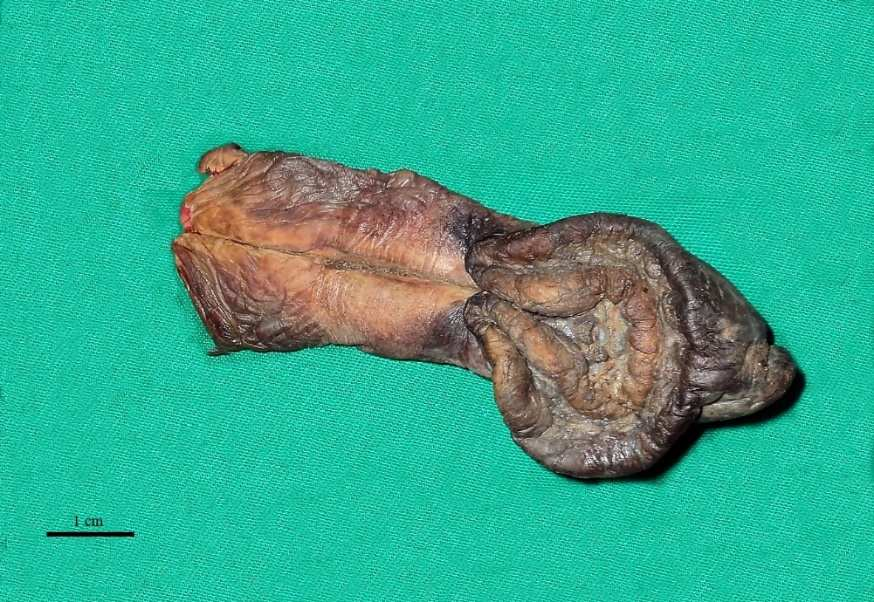 Pênis prolapsado removido de G. carbonaria.