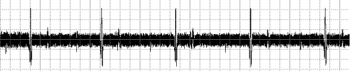 relativos aos tratamentos 02 e 03, podem ser observadas claramente as ondas P, R S e T.
