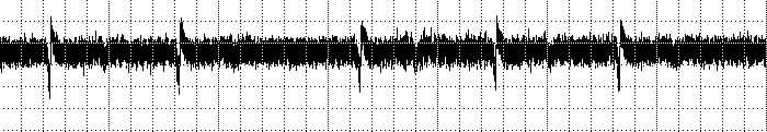 A 1 mv B Figura 30 Irregularidades no intervalo R-R (R-Ri) observadas no traçado eletrocardiográfico de duas fêmeas (A e B) de jabuti-piranga durante o tratamento 02 (0,6 segundos por divisão).
