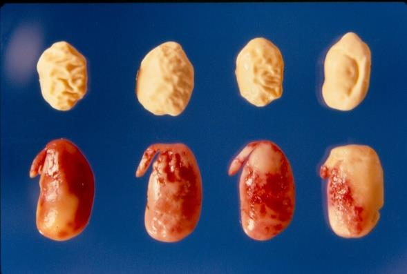 Esquerda: sementes secas com enrugamento; direita: sementes enrugadas coloridas pelo sal de tetrazólio. A expressão desse problema tem grande influência genética.