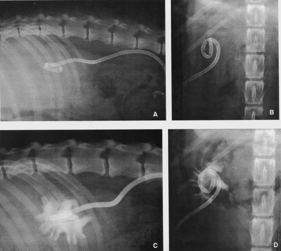 Nefrostomia percutânea ecoguiada em cães. 767 Figura 2 - Radiopacidade do cateter demonstrada por radiografias abdominais simples em projeção lateral (A) e ventrodorsal (B), pós-nefrostomia.