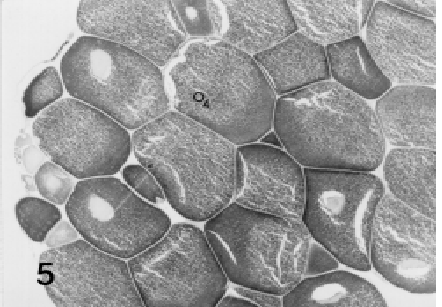 O núcleo, granuloso e levemente basófilo, apresentou muitos nucléolos acidófilos na periferia, aderidos à carioteca, bastante irregular.