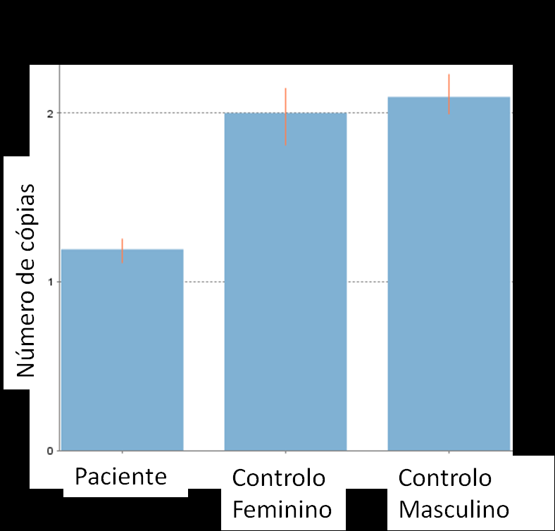 54 Devido à importância do gene afetado, foi realizada a técnica de qpcr que permitiu validar esta alteração, demonstrando a existência de apenas uma cópia do gene AUTS2 (Figura 25).