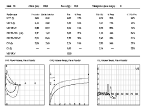 DISTÚRBIO OBSTRUTIVO Redução desproporcional de fluxos em relação ao volume pulmonar VEF1/ CV(F) < LI e VEF1 < LI: São os índices mais usados e padronizados para o diagnóstico de DVO VEF1/